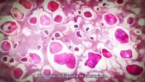 Gintama 2015 Episodio 11
